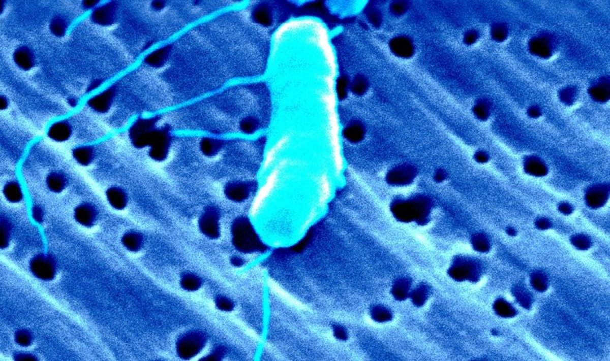 Bakterija Vibrio vulnificus