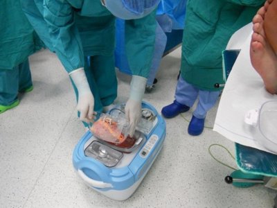 Inksto transplantacija