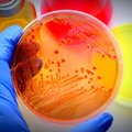 Mikrobų pavojus: kaip gyventi, kai turite svečių