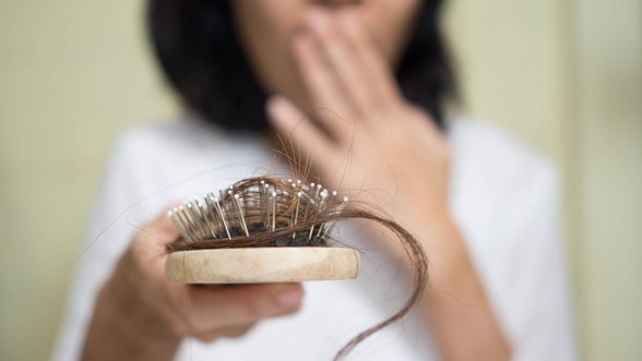 Požymiai, rodantys, kad jau laikas susirūpinti plaukų slinkimu: uždelsus gali ir nebeataugti