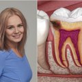 Odontologė patarė, kaip apsisaugoti nuo bakterijų, kurios sukelia kariesą: svarbi ir dantų pastos sudėtis