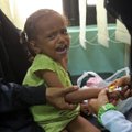 UNICEF: 11 mln. vaikų Jemene padėtis – apgailėtina