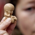 Abortas išgėrus tabletę: ministras įvardino, kada tai taps prieinama Lietuvoje