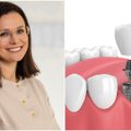 Gydytoja odontologė pasakė, ką svarbu žinoti apie dantų atkūrimą, kada rinktis protezavimą, kada – implantavimą