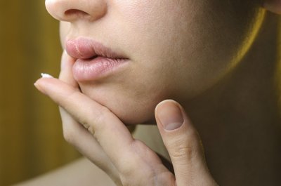Lūpų pūslelinės gydymas