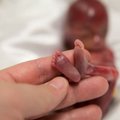 Skaudi realybė: fotografė įamžino savo 19 savaičių gimusį ir 5 minutes išgyvenusį sūnų