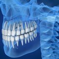 Su šia odontologine problema gyvena apie 80 proc. suaugusiųjų: dauguma nepastebi iki tol, kol pasekmės būna liūdnos