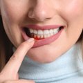 Kraujuojančios dantenos gali virsti klastinga liga: skausmo nejaučia metų metus, o pasekmės – liūdnos