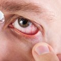 Įspėjo dėl akių lašų: kai kuriuos vartoti pavojinga
