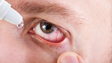 Įspėjo dėl akių lašų: kai kuriuos vartoti pavojinga