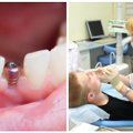 Darosi nebejuokinga: Lietuvoje dantis geriau rauti lauk, nei taisyti
