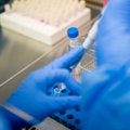 Azerbaidžane per parą užfiksuotas didžiausias nuo pandemijos pradžios užsikrėtimo koronavirusu atvejų skaičius