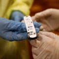 Europos sveikatos agentūra ragina atlikti daugiau koronaviruso testų ir spartinti skiepijimą