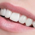 5 priežastys, kodėl dantyse atsiranda skylučių