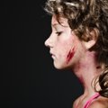 Biržų rajone žiauriai sumušta paauglė, užpuolikai mergaitei sulaužė koją