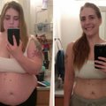 Prieš ir po: įspūdingi svorį numetusių žmonių pokyčiai