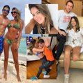 Po nesėkmingos operacijos „Mis Kolumbijai“ amputuota koja: praėjus kelioms savaitėms – karštas šokis