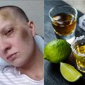 Buvusi benamė alkoholikė pasidalijo nuotraukomis prieš ir po: pokyčiai neįtikėtini