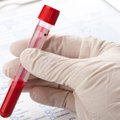 Lietuvoje pradedamas COVID-19 imuniteto tyrimas: daugiau kaip 6 tūkst. žmonių bus išsiųsti kvietimai tirtis kraują