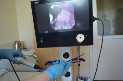 Vaizdo endoskopu galima tiksliai įvertinti ir išanalizuoti rijimo sutrikimą