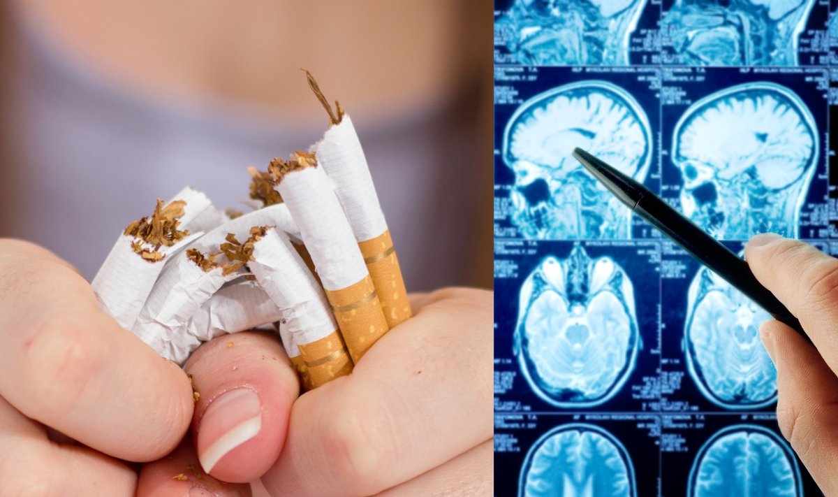 Mesti rūkyti gali padėti smegenų stimuliacija. 