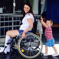 Draugės makiažo šepetėlį pasiskolinusi moteris liko paralyžiuota