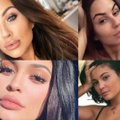 Kylie Jenner paskatino daugybę moterų grįžti prie natūralumo: vis daugiau jų atsisako lūpų putlinimo