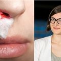 Kraujas iš nosies: kada pavojinga?