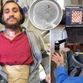 Musko „Neuralink“ parodė savo pirmąjį pacientą, kuriam implantuotas smegenų lustas: ką jis jau sugeba?