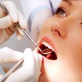 Nauji odontologijos stebuklai: dantų taisymas be skausmo ir visam gyvenimui