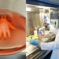 Gyvybiškai svarbius eksperimentus atliekanti mokslininkė Virginija Bukelskienė: kai kuriuos žmogaus organus jau keičia dirbtiniai