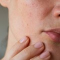 Požymiai, jog reikia susirūpinti, – kada oda siunčia signalus apie ligas?