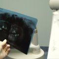 „Mano sveikata“: išsamiai apie dantų implantaciją