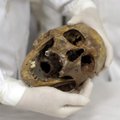 Šalčininkų rajone rasti žmogaus kaukolės fragmentai