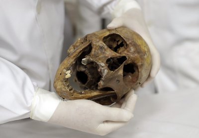 Josefo Mengelės kaukole San Paulo universitete