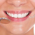 Dantų balinimas: namuose ar gydytojo kabinete?