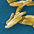 Seimo narys siūlo priverstinai gydyti sergančius atvira tuberkulioze