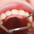 „Nevelmei“ – bauda už nesaugią dantų pastą