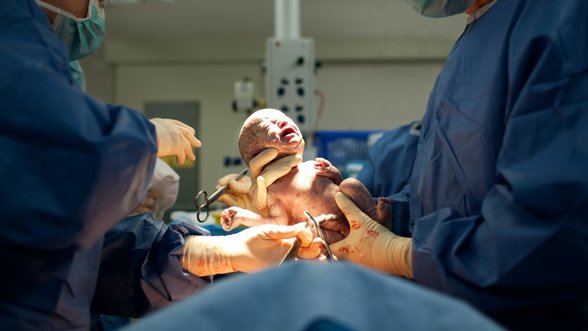SAM: esant rizikos faktoriams gimdyvės galės prašyti cezario pjūvio operacijos