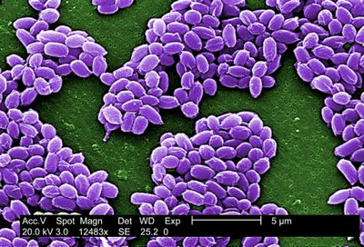 Bakterija (E-coli) pro mikroskopą  // Vaiko rankos ultravioletinėje šviesoje (ryškiau šviečia bakterijos), pažaidus viešoje erdvėje padėtų žaislu