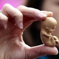 Lietuvoje atliekama tūkstančiai abortų, tačiau tėra viena būklė, kai tai neišvengiama