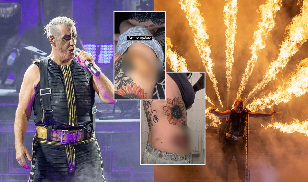 „Rammstein“ koncertas Vingio parke, Shelby Lynn sužeidimai