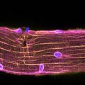 Mikroskopu darytose nuotraukose užfiksuota, kas vyksta skaudančiuose raumenyse po treniruotės: mokslininkai tokius procesus stebi pirmą kartą