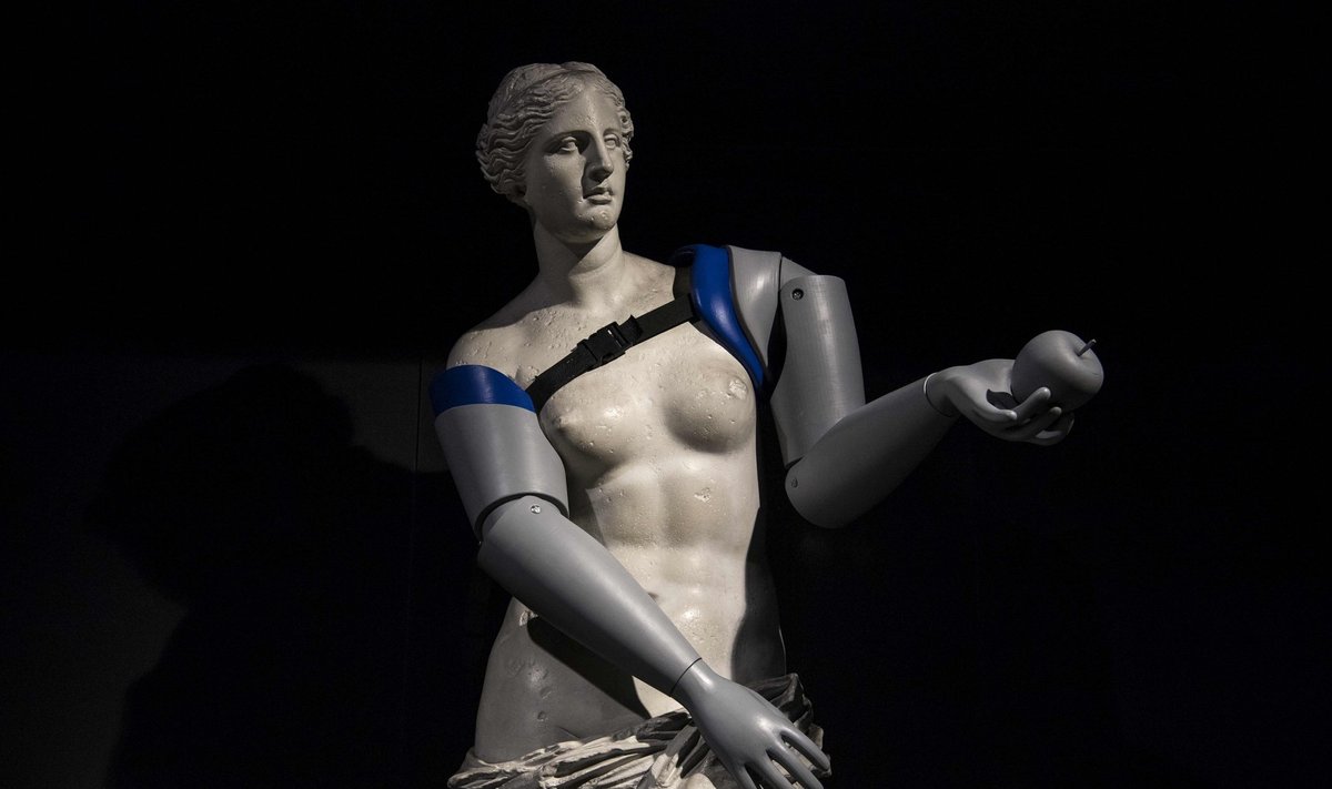 Milo Venerai trimačiais spausdintuvais pagamino rankų protezus