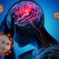 SARS-Cov-2 virusas sugeba patekti į žmogaus smegenis, bet tai jis padaro ne per PGR testus