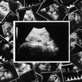 Sveikatos apsaugos ministerija abortų draudimui nepritaria