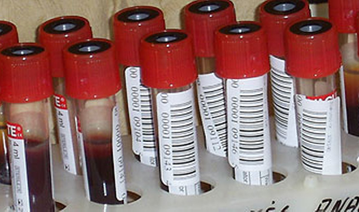 Kraujo mėginiai su brūkšniniais kodais („Medicina practica“ nuotrauka)