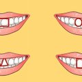 Įdomus testas: kaip nustatyti žmogaus charakterį pagal jo dantis