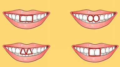 Įdomus testas: kaip nustatyti žmogaus charakterį pagal jo dantis