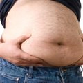 Apetitu nesiskundžiame: skrandžių mažinimas valstybei kainuoja milijonus
